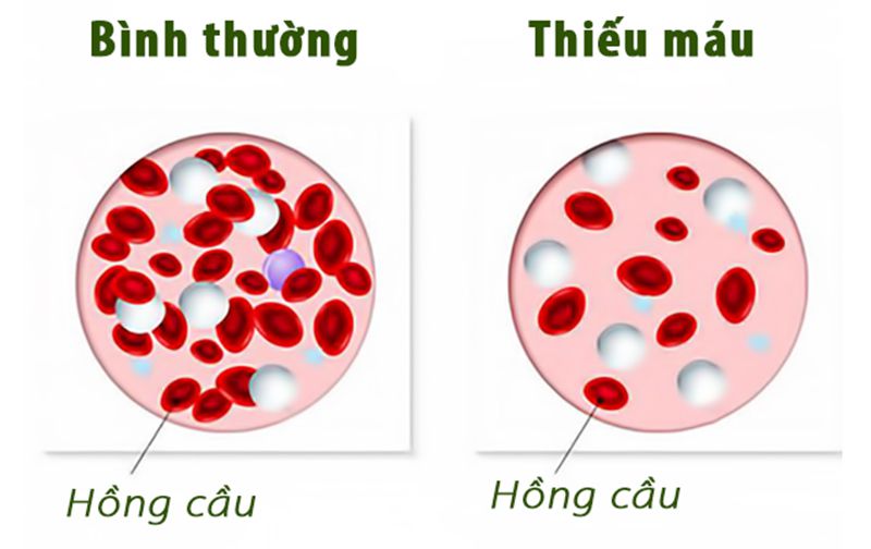 Hạt điều rang muối chọn làm món ăn vặt hay bữa ăn phụ, vì được nhiều người yêu thích và lựa chọn sử dụng vì chứa khá nhiều chất dinh dưỡng. Không chỉ có nhiều dưỡng chất, bổ sung năng lượng cho cơ thể hoạt động, chúng còn mang đến nhiều lợi ích tốt cho sức khỏe người dùng.