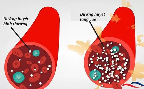 Hóa chất Magie Sulfate là gì? Chúng có bao nhiêu dạng khác nhau, công dụng cũng như cấu tạo như thế nào? Những tính chất lý hóa nào đặc trưng cho MgSO4? Muối Epsom được điều chế bằng cách nào? Magnesium sulfate có tác dụng gì? Khi sử dụng và bảo quản chúng ta cần phải lưu ý những điều gì?